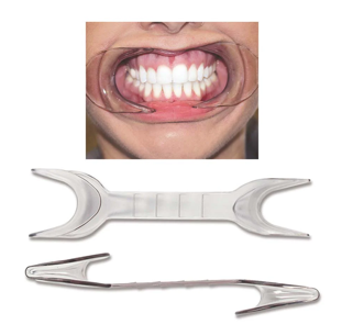 Cheek retractor double ended autoclavable (2pc)